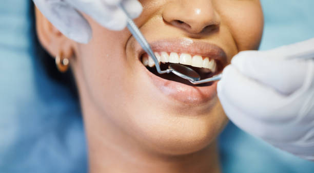 Best Emergency Root Canal Treatment in Maxwell, CA