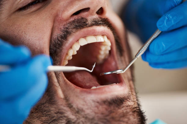 Best Emergency Gum Treatment in Maxwell, CA