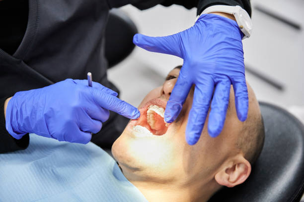 Best Same-Day Emergency Dental Services in Maxwell, CA