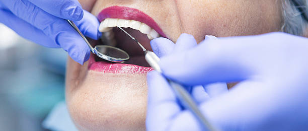 Best Emergency Dental Care for Broken or Chipped Teeth in Maxwell, CA